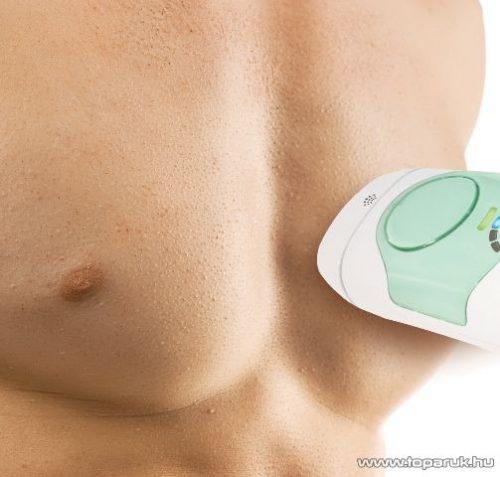 Homedics IPL-HH150 DUO AFT+IPL villanófényes tartós szőrtelenítő készülék - készlethiány